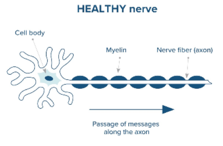 Healthy and damaged nerves