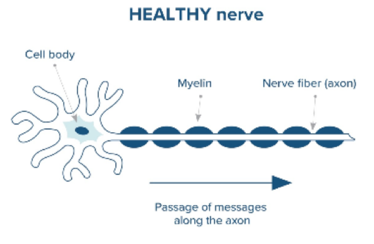 Healthy and damaged nerves